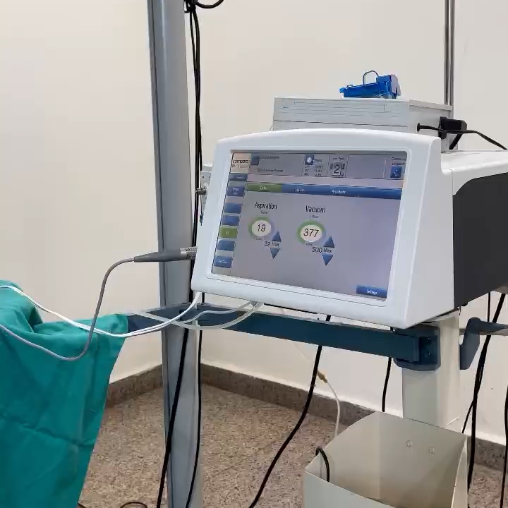 The phacoemulsification console showing live aspiration and vacuum readings